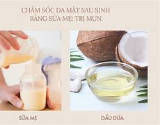 Mẹ Sau Sinh Chăm Sóc Da Mặt